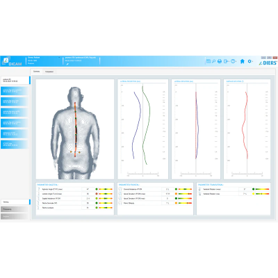 DIERS postura - SOFTWARE (licença)