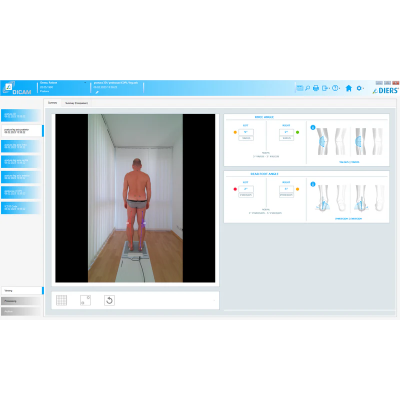 DIERS postura - SOFTWARE (licença)