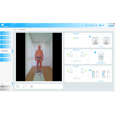 DIERS postura - SOFTWARE (licença)